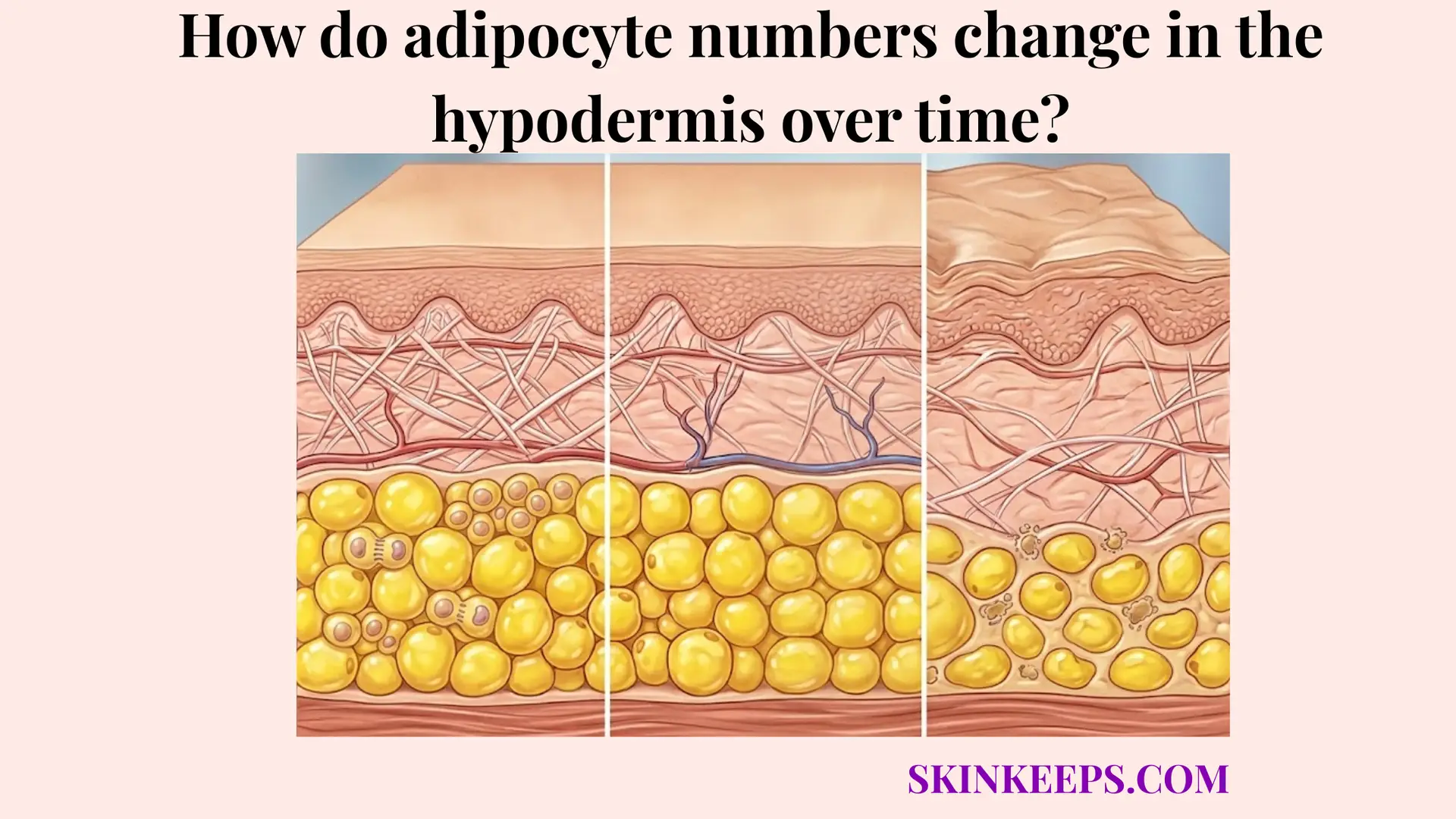 adipocyte numbers change in the hypodermis over time