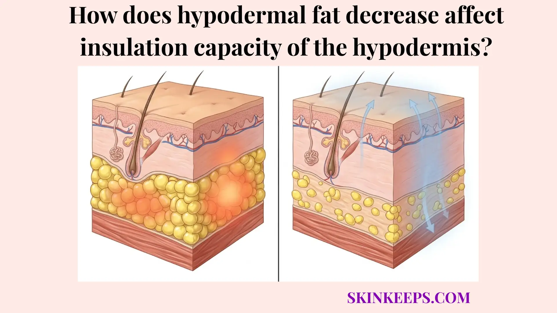 hypodermal fat decrease affect insulation capacity of the hypodermis
