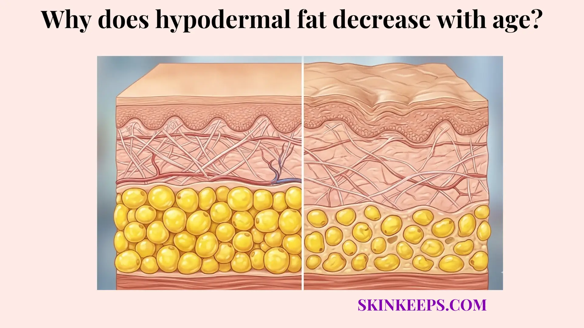 hypodermal fat decrease with age