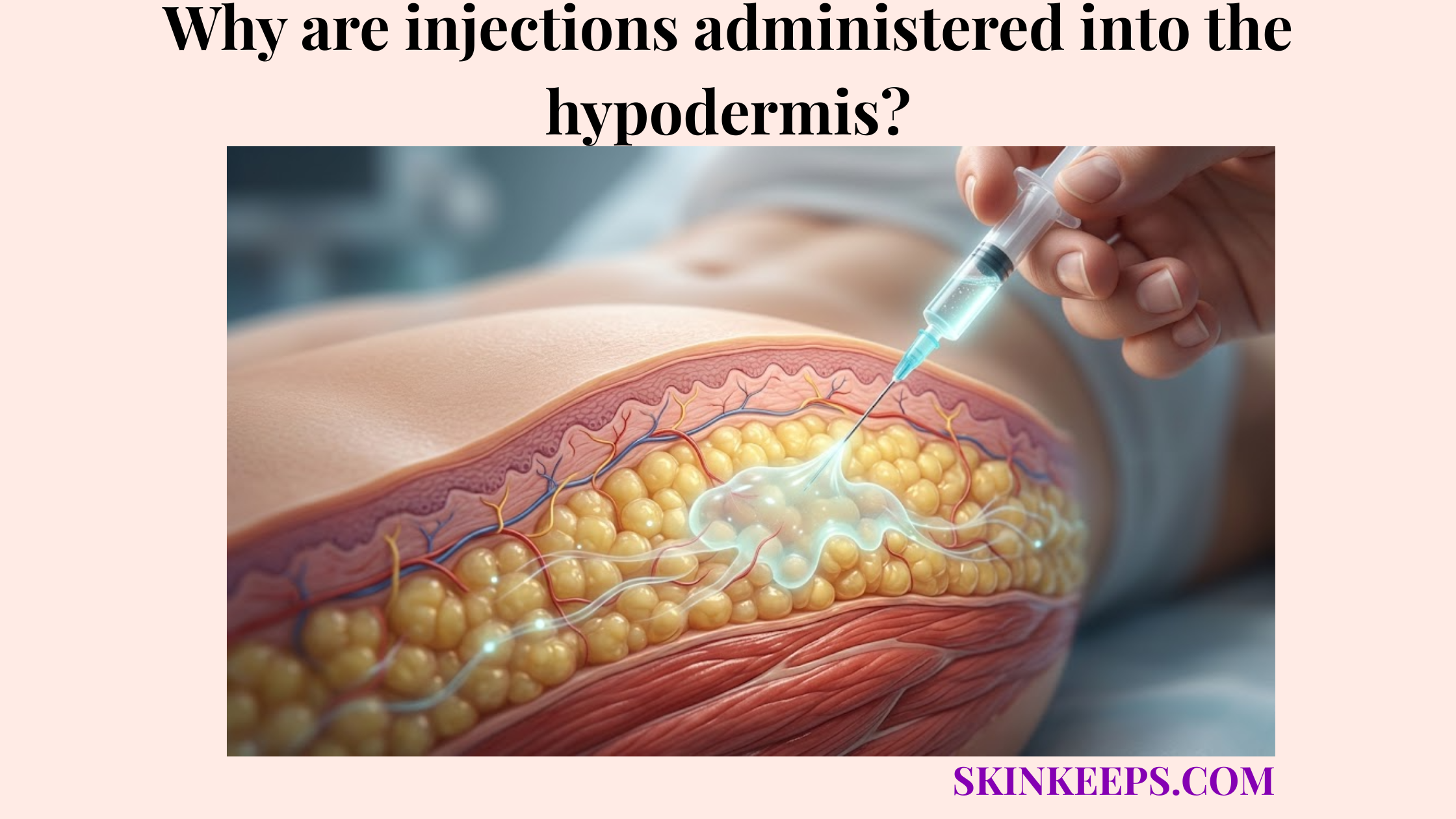 Injections administered into the hypodermis