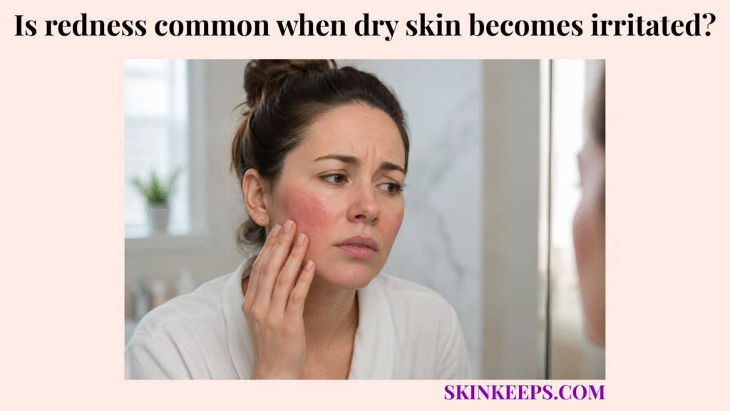 Woman touching a red, irritated cheek while looking in the mirror.