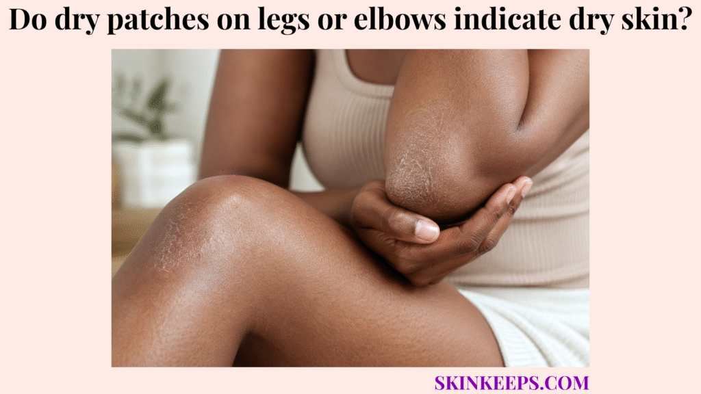 dry patches on legs or elbows indicate dry skin