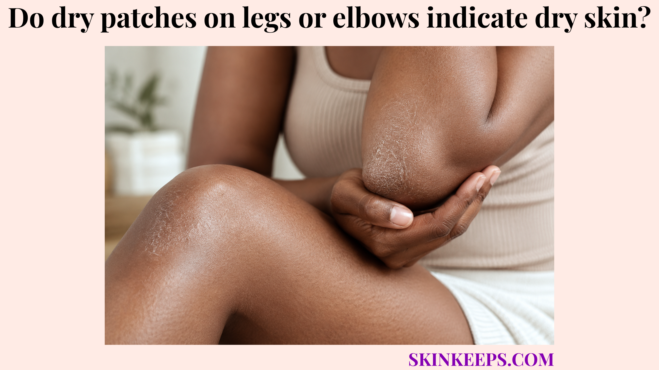 dry patches on legs or elbows indicate dry skin