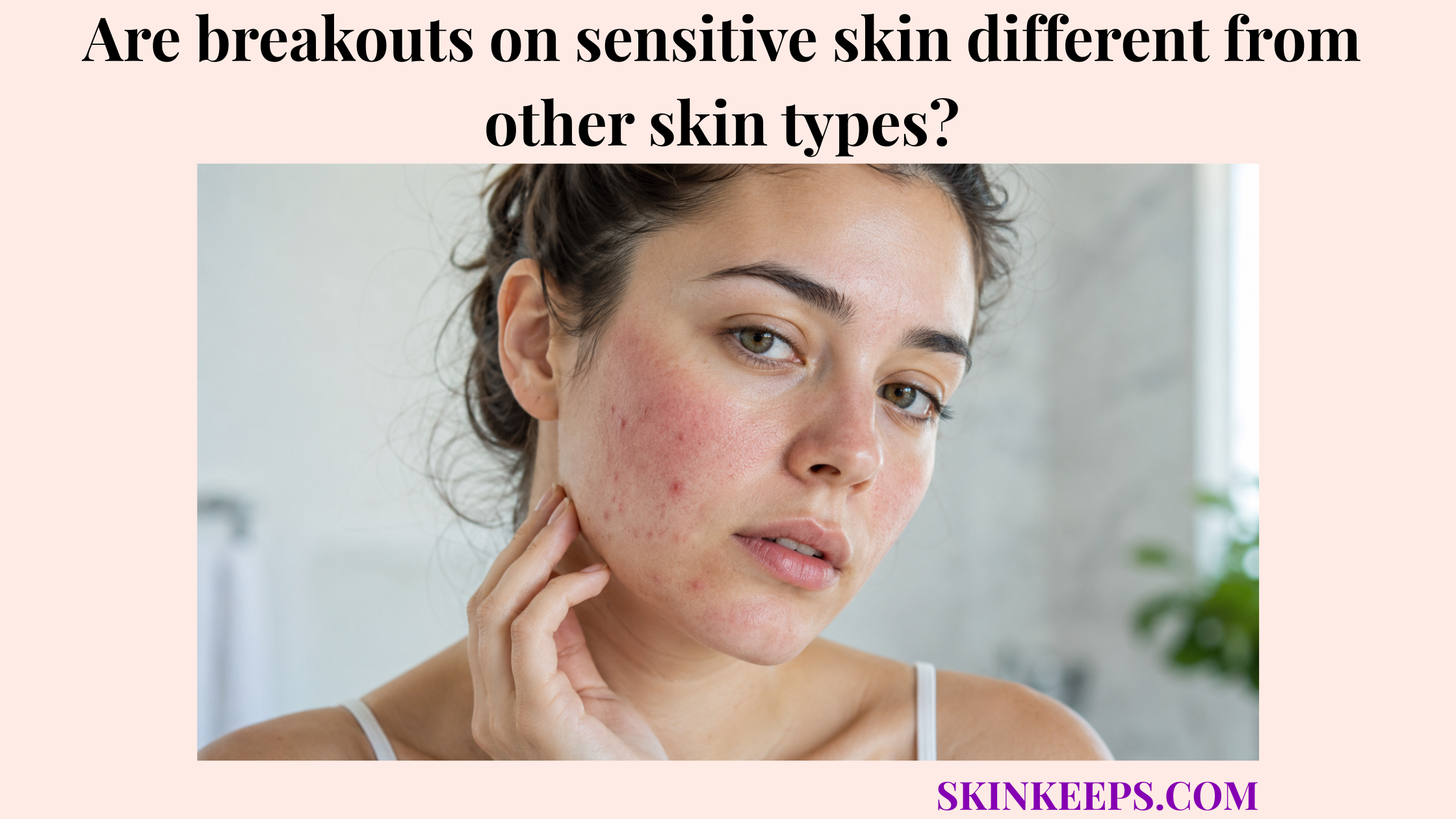 Realistic close-up illustration of sensitive skin breakouts with mild redness, small inflamed bumps, and visible irritation on the cheek and jawline.