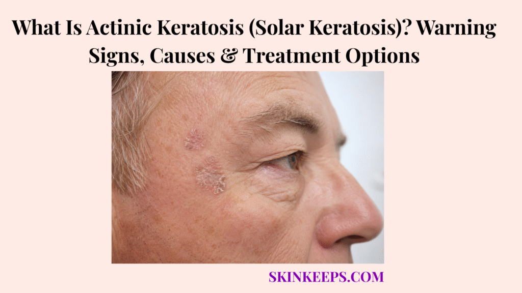 What Is Actinic Keratosis (Solar Keratosis)? Warning Signs, Causes & Treatment Options
