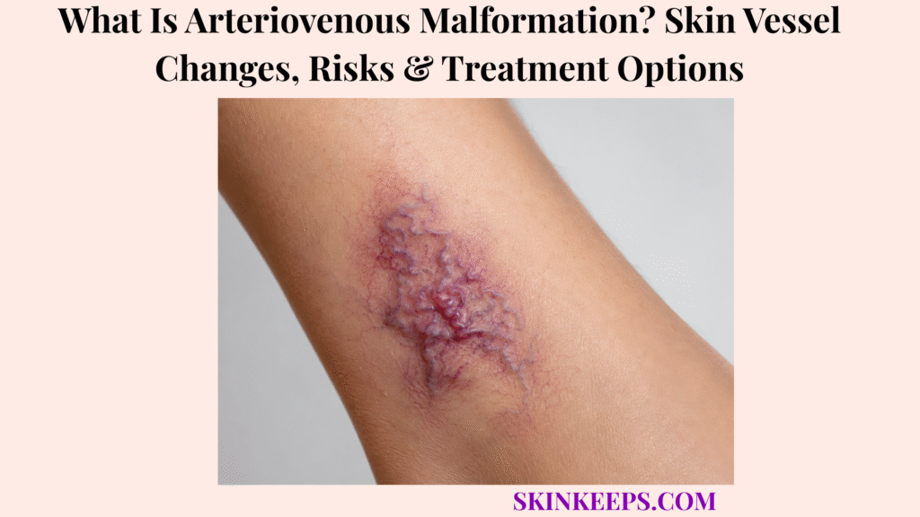 What Is Arteriovenous Malformation? Skin Vessel Changes, Risks & Treatment Options