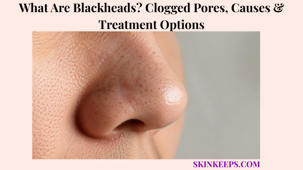 Realistic close-up of blackheads on the nose showing enlarged pores and multiple small dark open comedones.