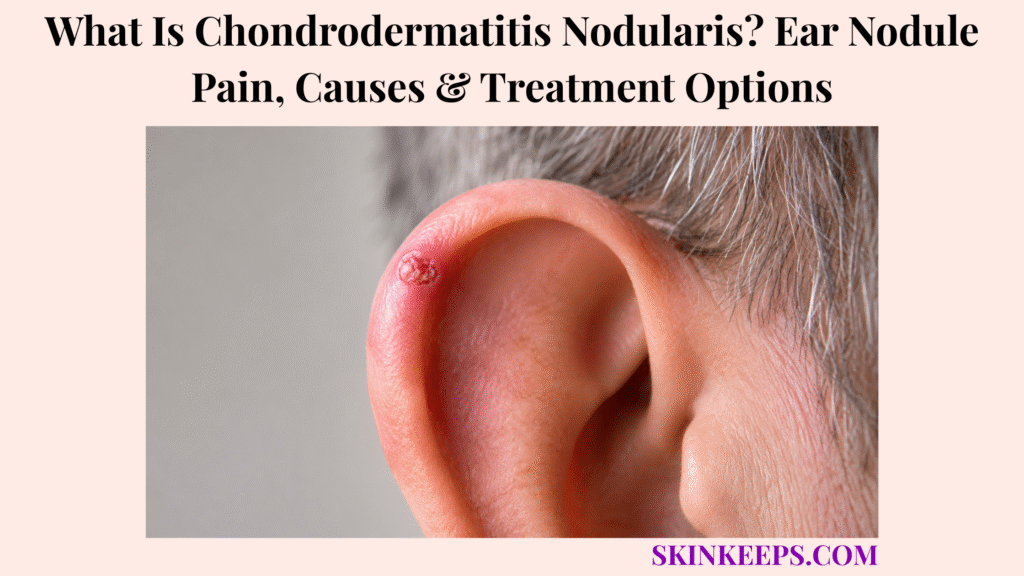 What Is Chondrodermatitis Nodularis? Ear Nodule Pain, Causes & Treatment Options