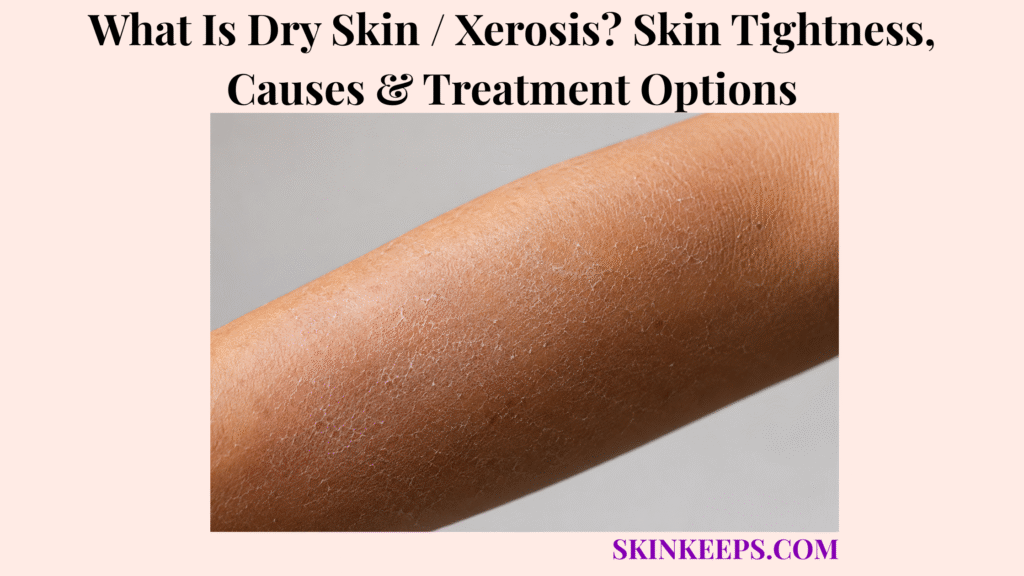 What Is Dry Skin / Xerosis? Skin Tightness, Causes & Treatment Options