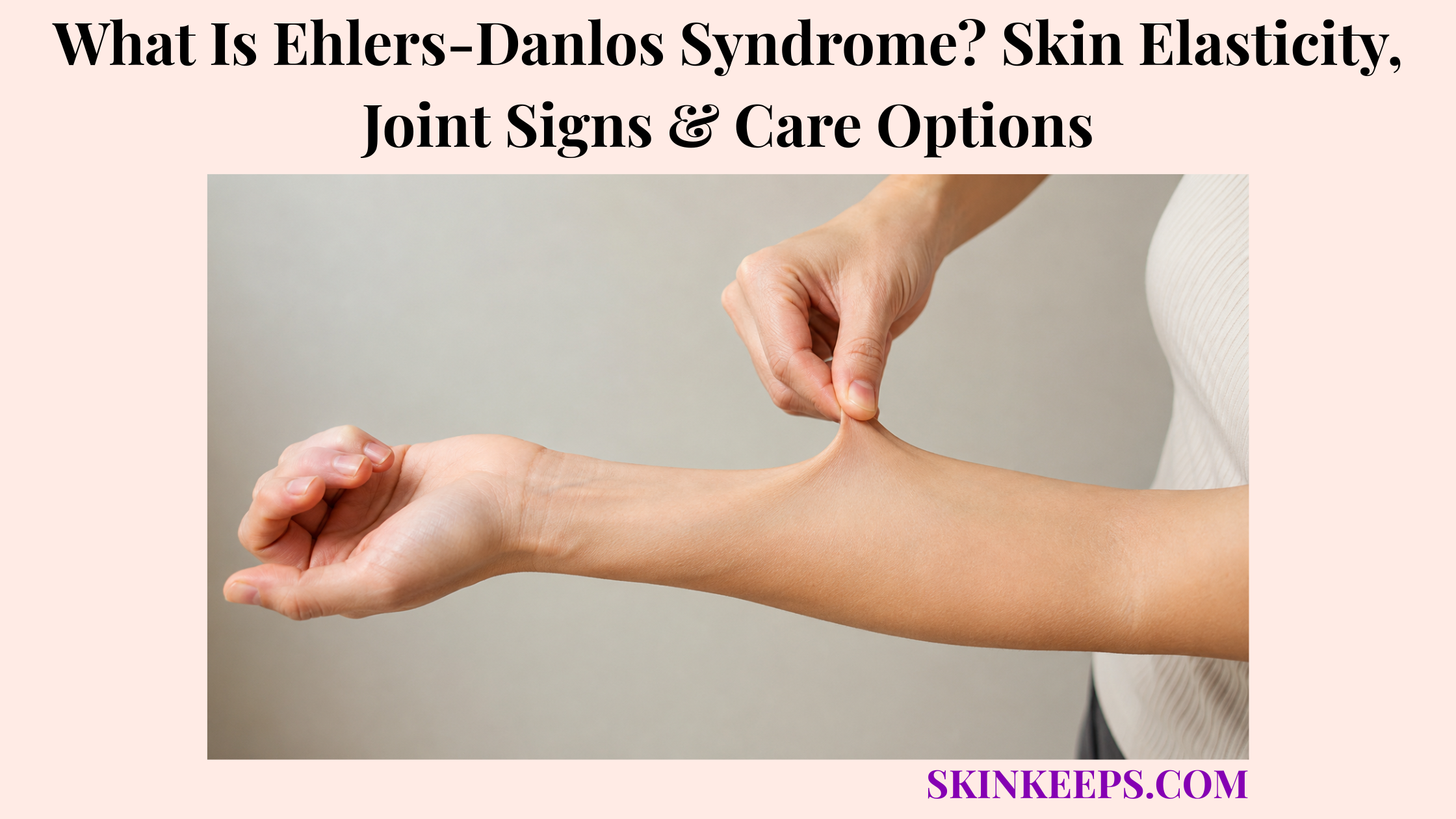 What Is Ehlers-Danlos Syndrome? Skin Elasticity, Joint Signs & Care Options