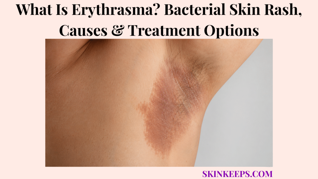 What Is Erythrasma? Bacterial Skin Rash, Causes & Treatment Options