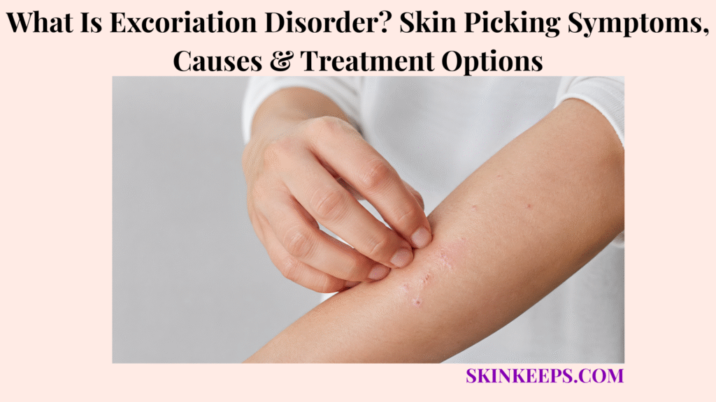 What Is Excoriation Disorder? Skin Picking Symptoms, Causes & Treatment Options