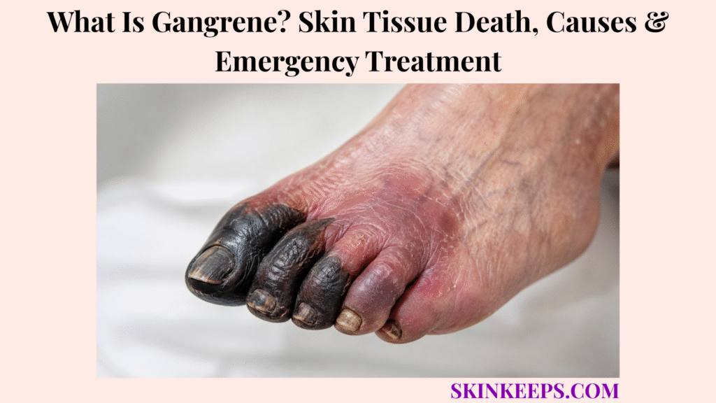 What Is Gangrene? Skin Tissue Death, Causes & Emergency Treatment