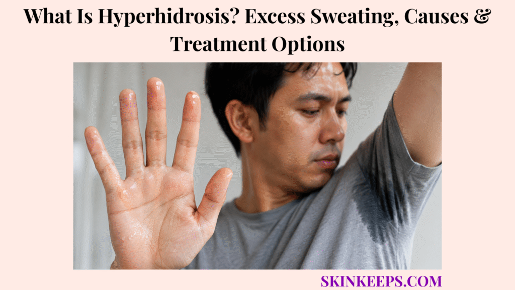What Is Hyperhidrosis? Excess Sweating, Causes & Treatment Options