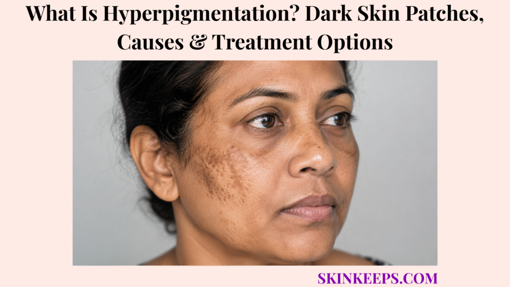 What Is Hyperpigmentation? Dark Skin Patches, Causes & Treatment Options