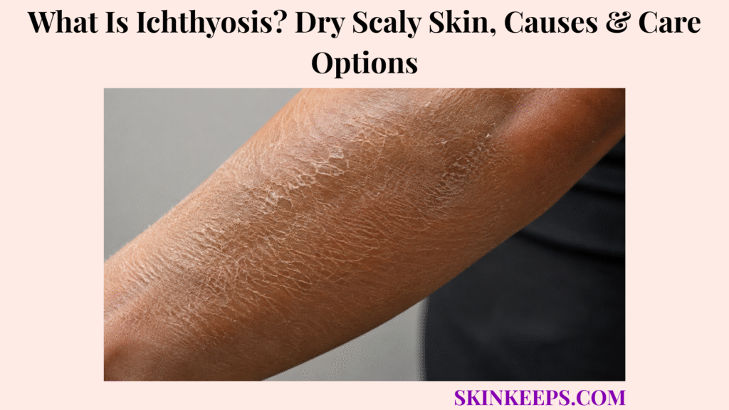 What Is Ichthyosis? Dry Scaly Skin, Causes & Care Options
