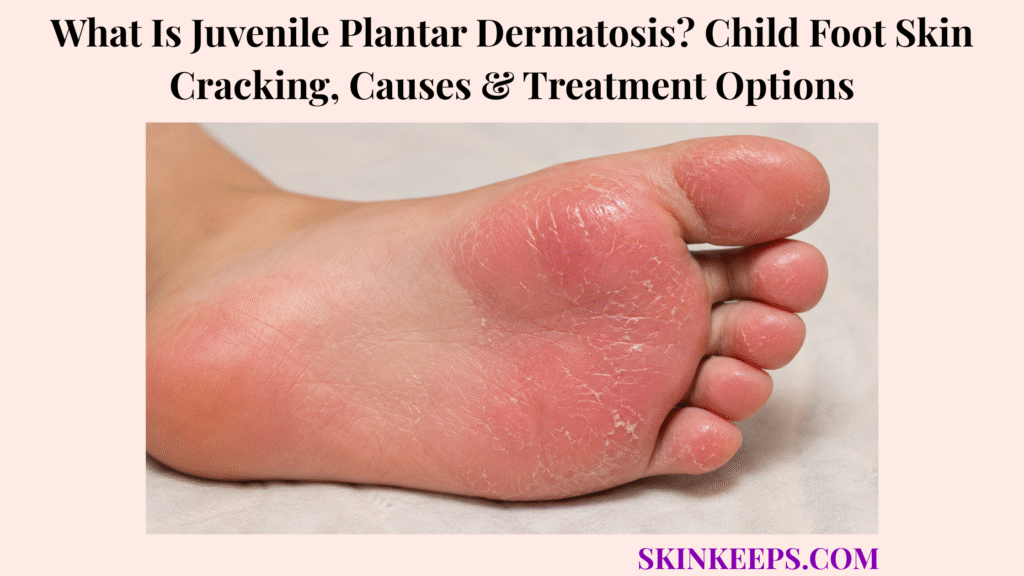 What Is Juvenile Plantar Dermatosis? Child Foot Skin Cracking, Causes & Treatment Options