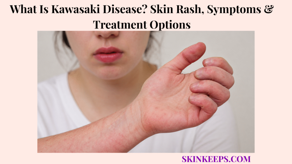 What Is Kawasaki Disease? Skin Rash, Symptoms & Treatment Options