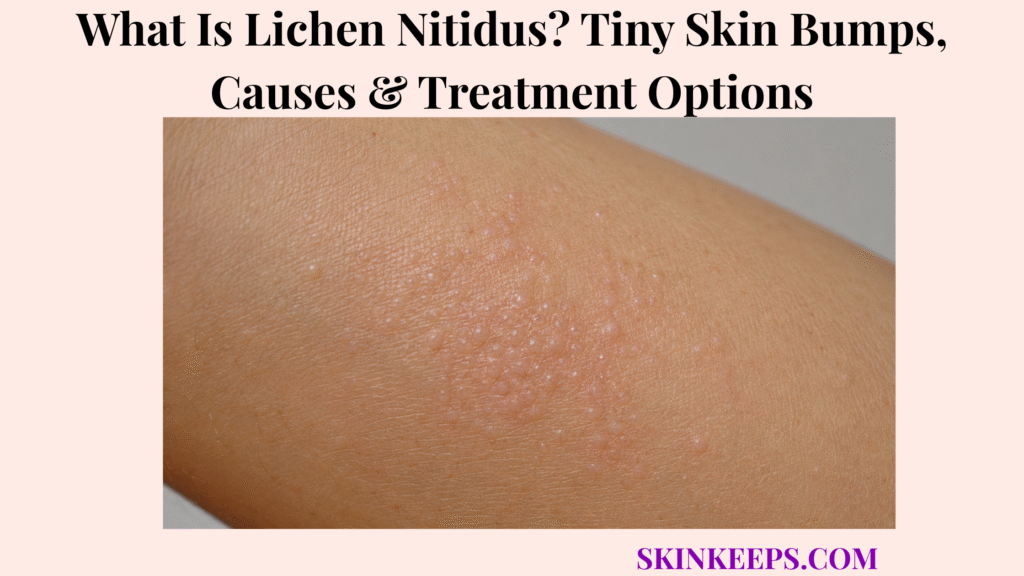 What Is Lichen Nitidus? Tiny Skin Bumps, Causes & Treatment Options