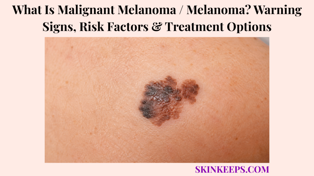 What Is Malignant Melanoma / Melanoma? Warning Signs, Risk Factors & Treatment Options