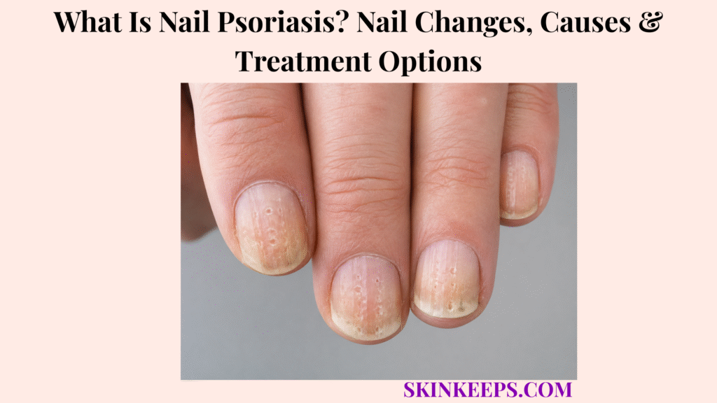 What Is Nail Psoriasis? Nail Changes, Causes & Treatment Options