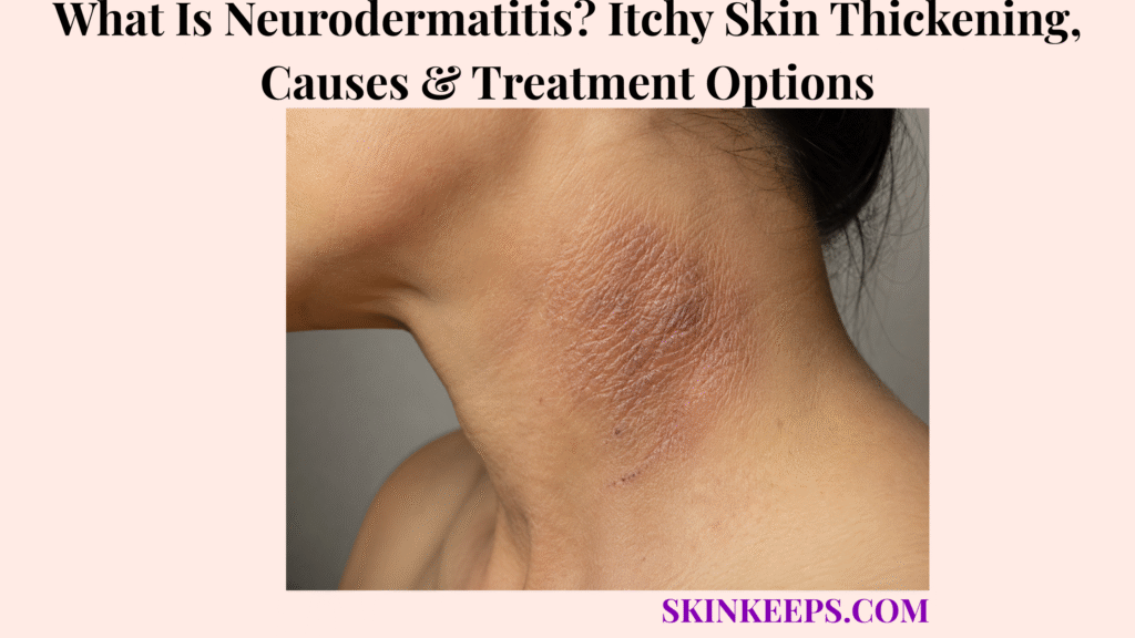 What Is Neurodermatitis? Itchy Skin Thickening, Causes & Treatment Options