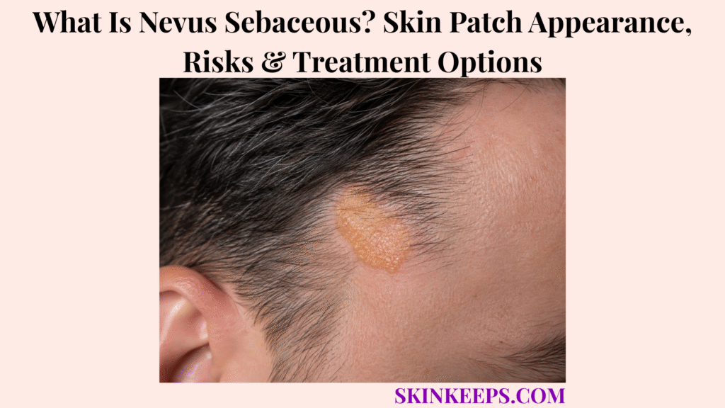 What Is Nevus Sebaceous? Skin Patch Appearance, Risks & Treatment Options