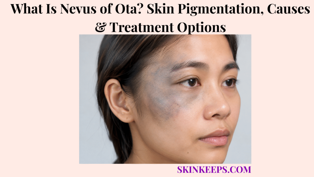 What Is Nevus of Ota? Skin Pigmentation, Causes & Treatment Options