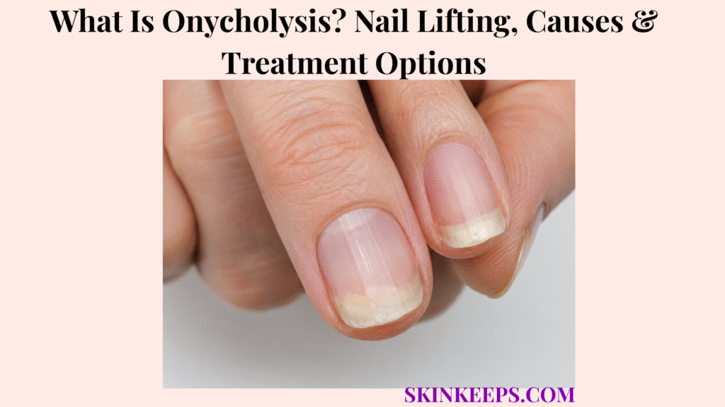 What Is Onycholysis? Nail Lifting, Causes & Treatment Options