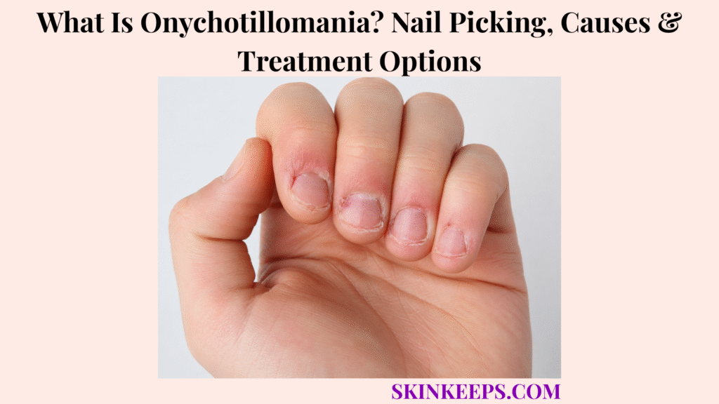 What Is Onychotillomania? Nail Picking, Causes & Treatment Options