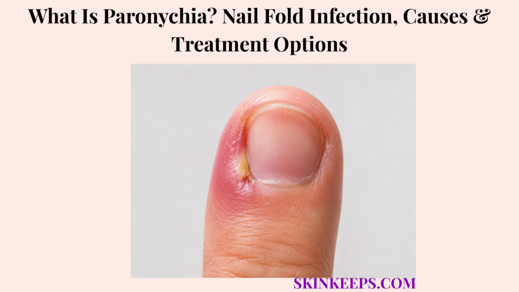 What Is Paronychia? Nail Fold Infection, Causes & Treatment Options