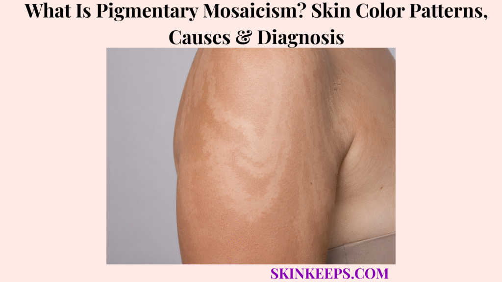 What Is Pigmentary Mosaicism? Skin Color Patterns, Causes & Diagnosis