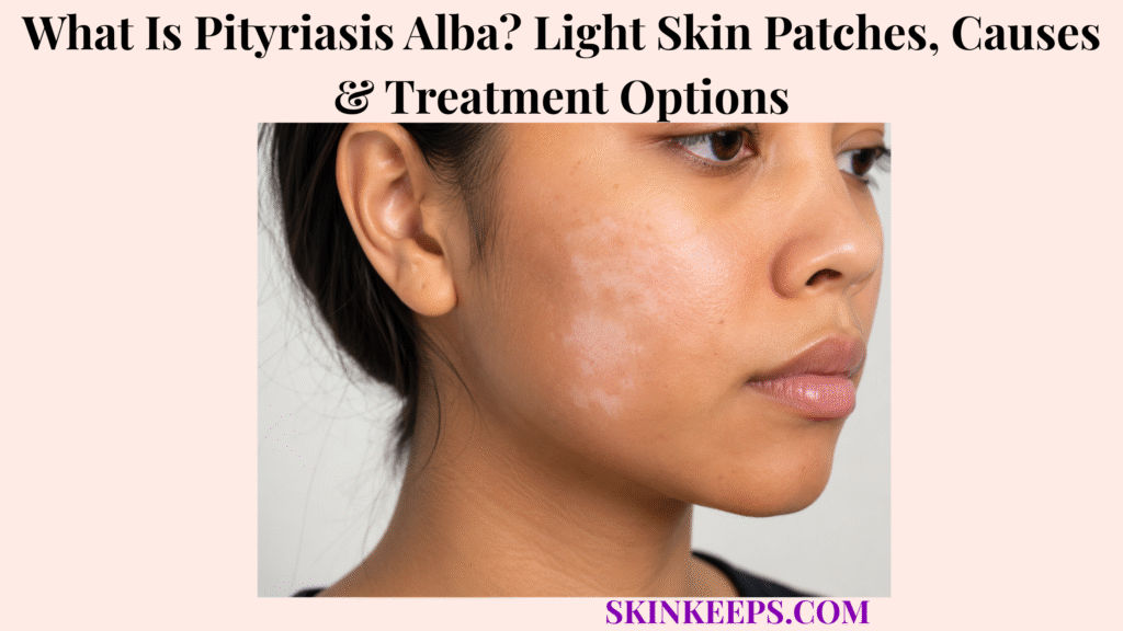 What Is Pityriasis Alba? Light Skin Patches, Causes & Treatment Options