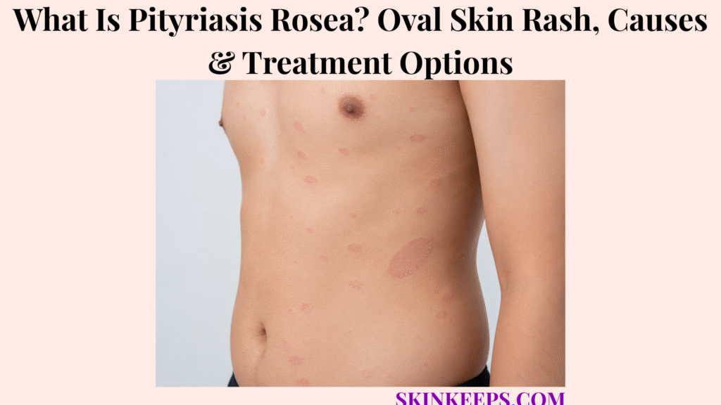 What Is Pityriasis Rosea? Oval Skin Rash, Causes & Treatment Options