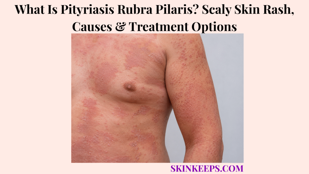 What Is Pityriasis Rubra Pilaris? Scaly Skin Rash, Causes & Treatment Options