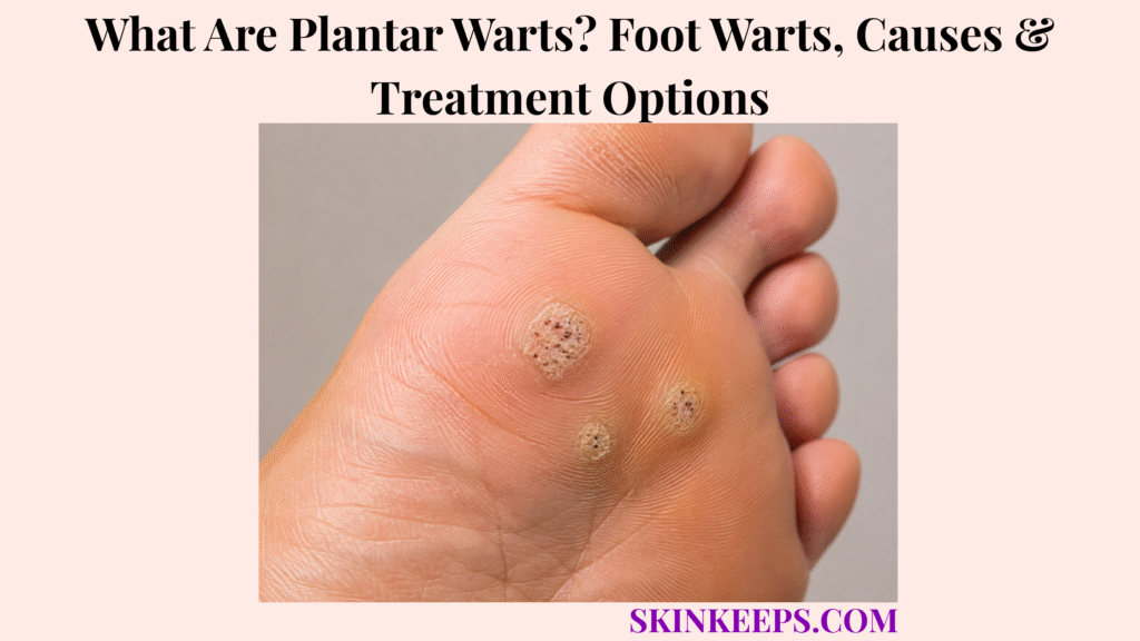 What Are Plantar Warts? Foot Warts, Causes & Treatment Options