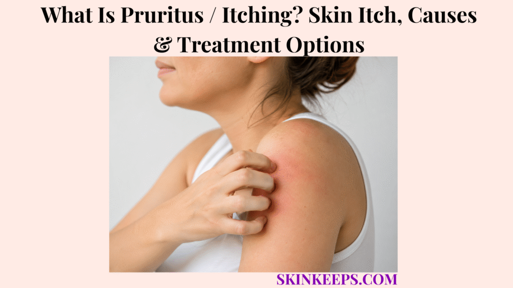 What Is Pruritus / Itching? Skin Itch, Causes & Treatment Options