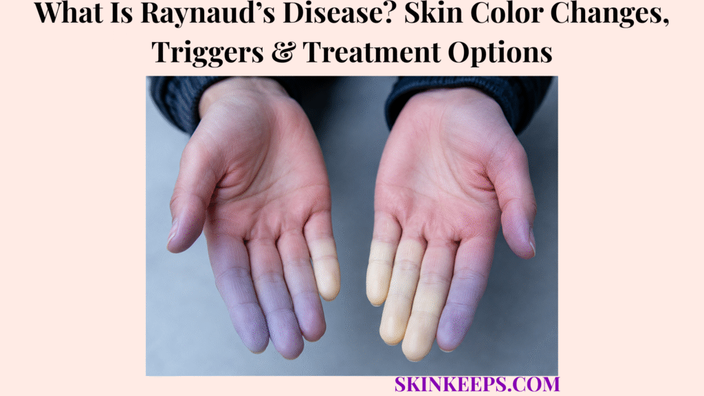 What Is Raynaud’s Disease? Skin Color Changes, Triggers & Treatment Options