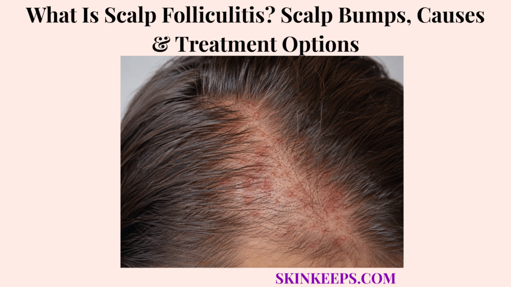 What Is Scalp Folliculitis? Scalp Bumps, Causes & Treatment Options