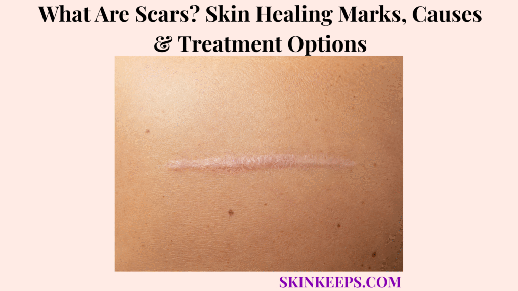 What Are Scars? Skin Healing Marks, Causes & Treatment Options
