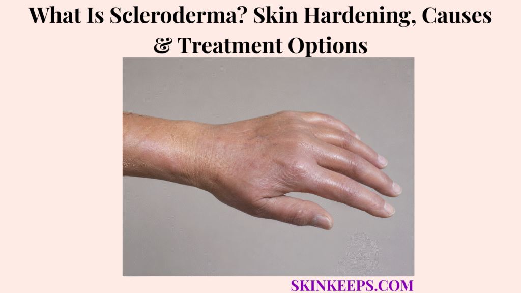 What Is Scleroderma? Skin Hardening, Causes & Treatment Options
