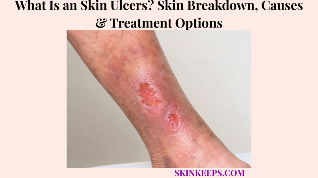 What Are Skin Ulcers? Skin Breakdown, Causes & Treatment Options