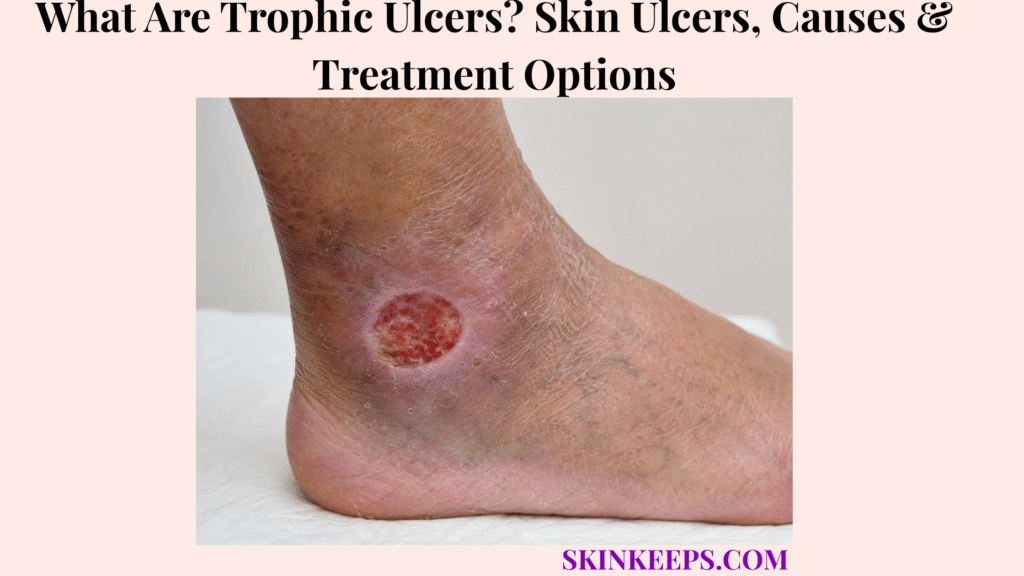 What Are Trophic Ulcers? Skin Ulcers, Causes & Treatment Options