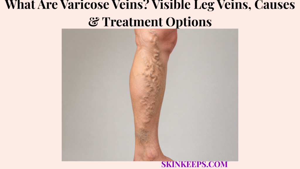 What Are Varicose Veins? Visible Leg Veins, Causes & Treatment Options