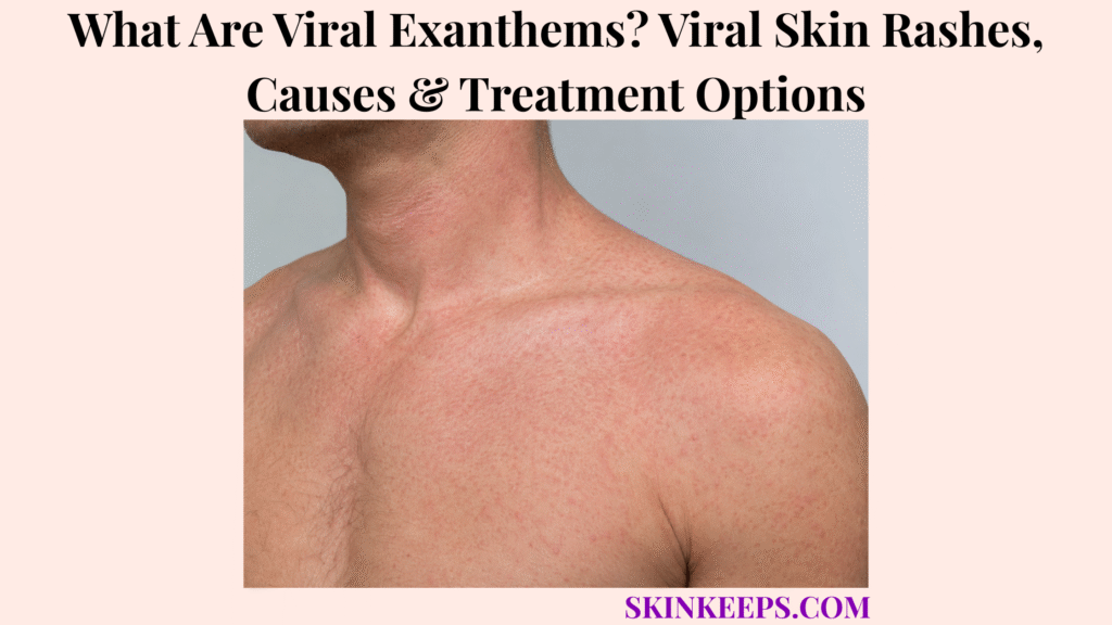 What Are Viral Exanthems? Viral Skin Rashes, Causes & Treatment Options