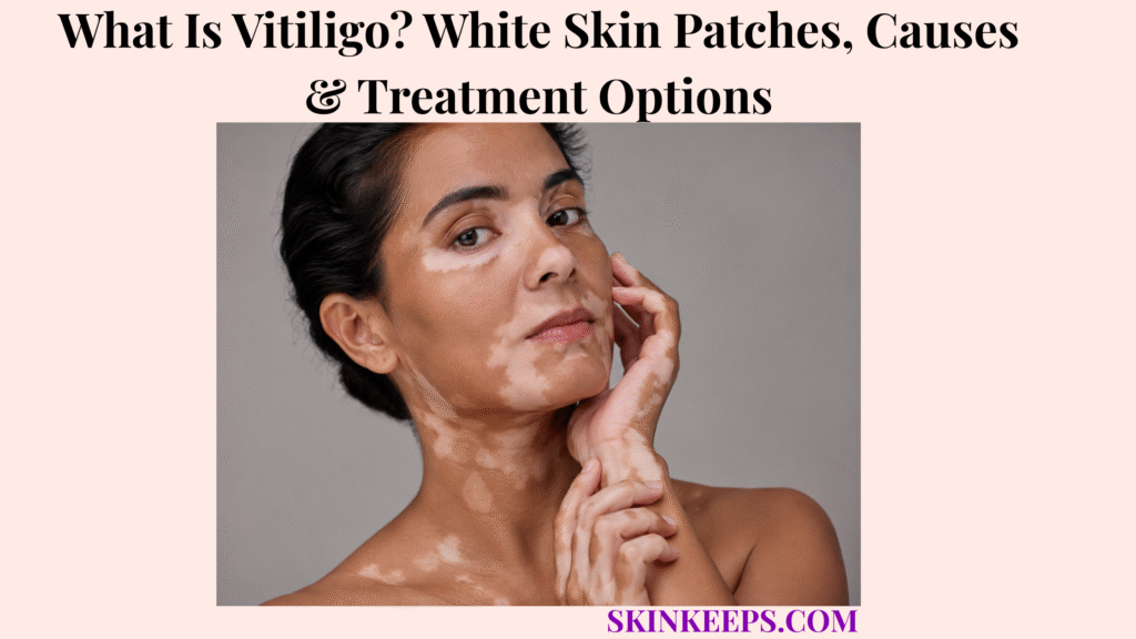 What Is Vitiligo? White Skin Patches, Causes & Treatment Options