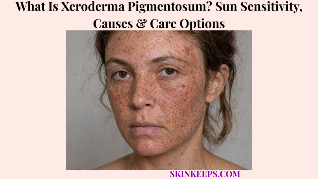 What Is Xeroderma Pigmentosum? Sun Sensitivity, Causes & Care Options